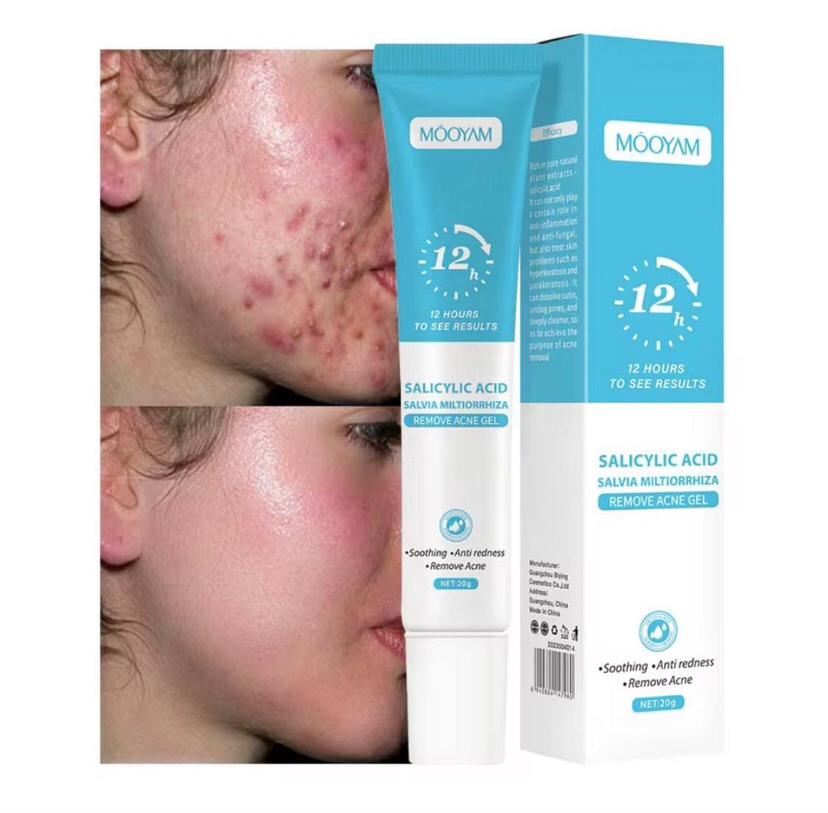 🌿 Gel Anti-Tâches &amp; Anti-Acné Mooyam – Acide Salicylique &amp; Salvia Miltiorrhiza