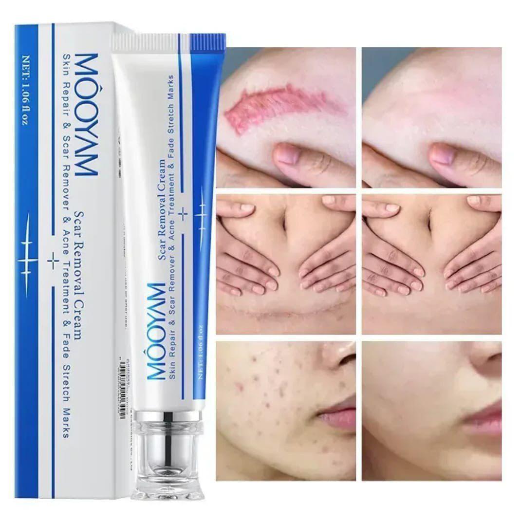 ✨ Mooyam – Crème Anti-Taches Corps & Visage