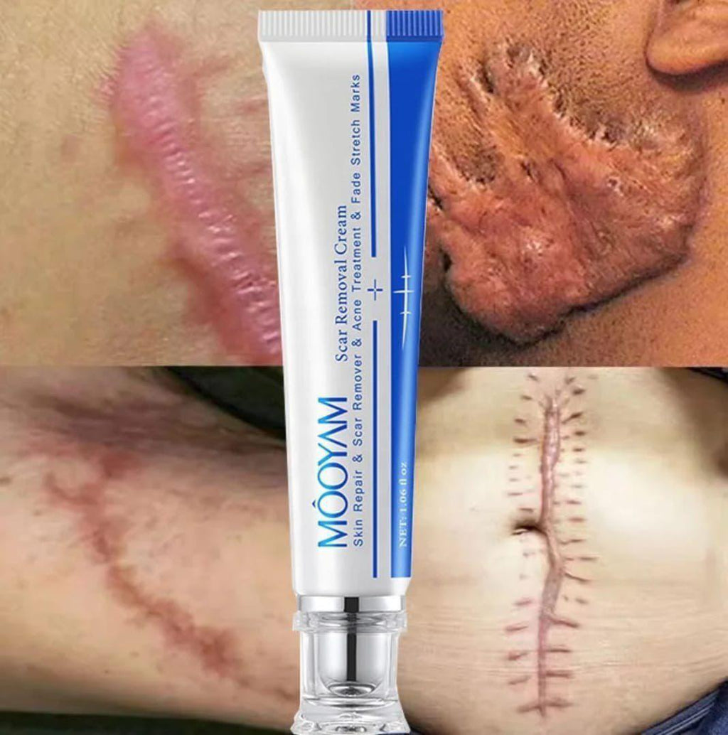 ✨ Mooyam – Crème Anti-Taches Corps & Visage