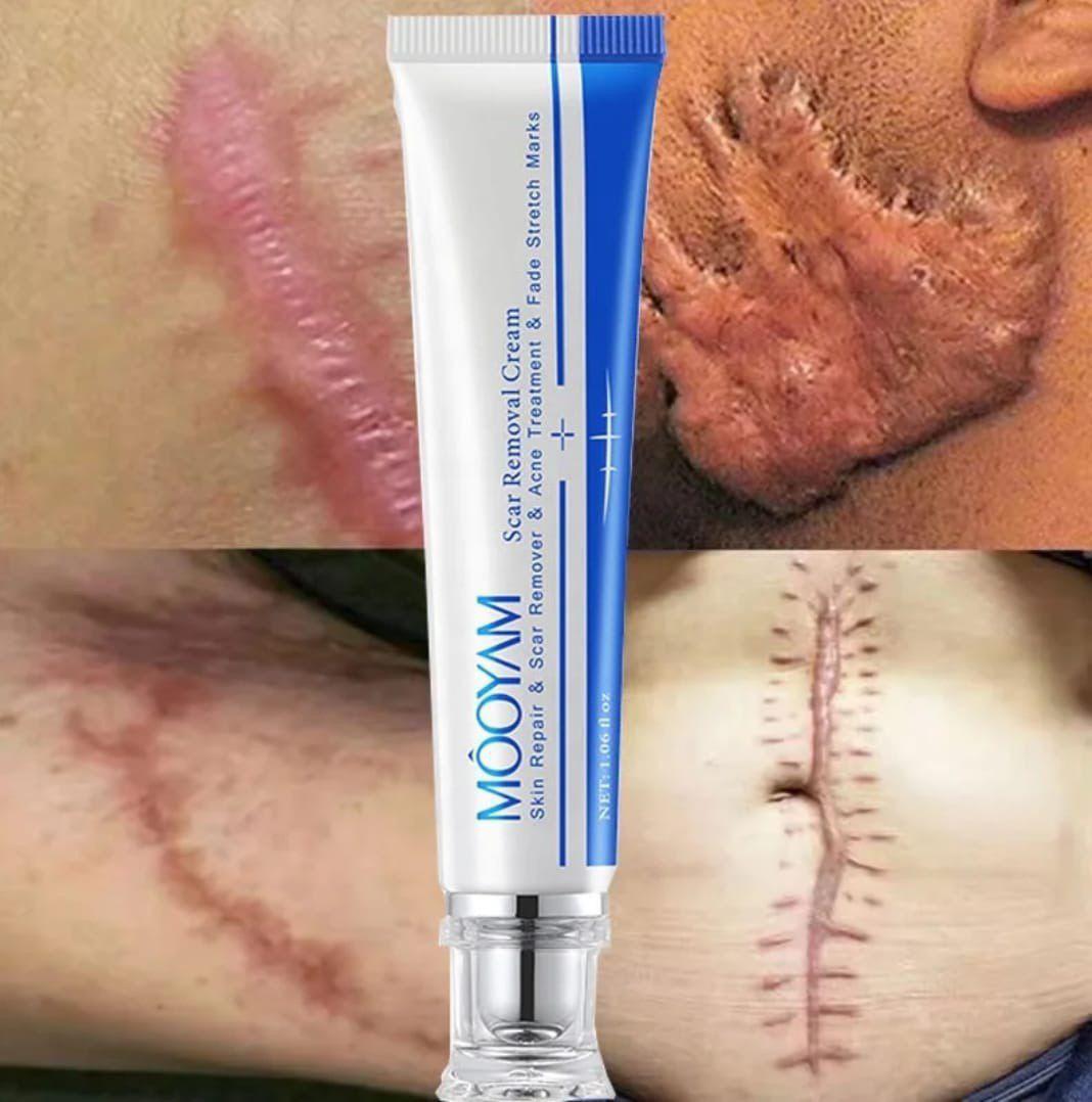 ✨ Mooyam – Crème Anti-Taches Corps & Visage