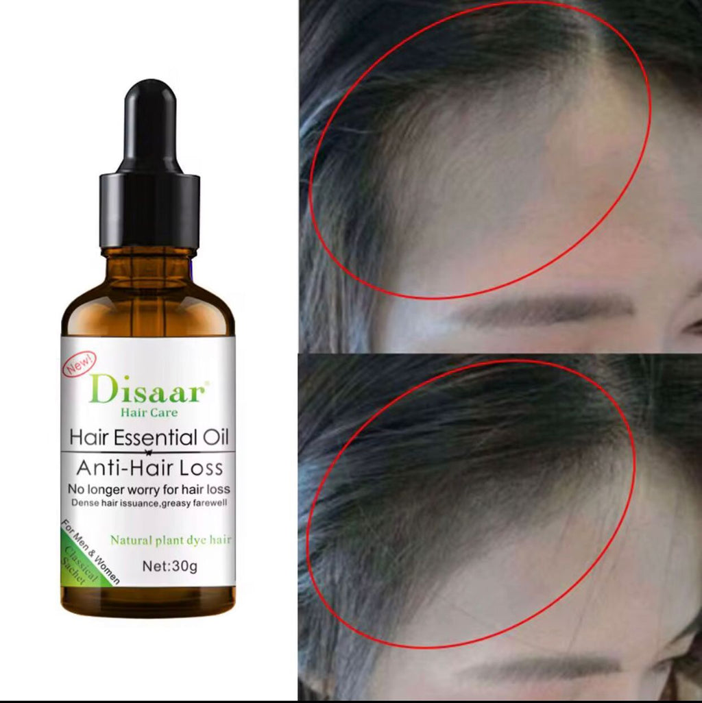 Disaar Hair Essential Oil – Anti-Hair Loss